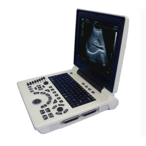 3D Abdominal Ultrasound Scan